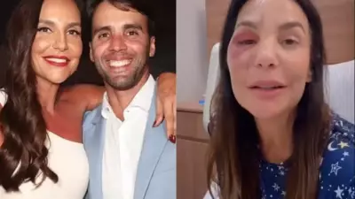 Daniel Cady tranquiliza fãs sobre recuperação de Ivete Sangalo após cirurgia facial
