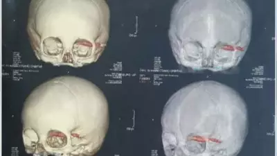 Estudo revela que prática de escurecer dentes no Vietnã é milenar