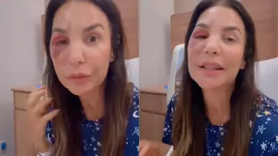 Ivete Sangalo se recupera após cirurgia por fratura facial após desmaio em Salvador