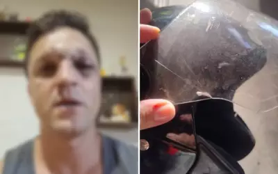 Motociclista tem rosto cortado por linha com cerol em Barretos e recebe 26 pontos