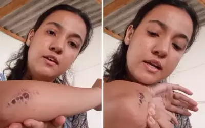 Mulher alega ter sido atropelada por ex-sogro em discussão por cadeirinha da filha em Franca