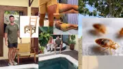 Ator Lucas Malvacini sofre reação alérgica grave em Bali após picadas de percevejos