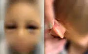 Criança de 6 anos é internada com sinais de maus-tratos após agressões do pai em Goiânia