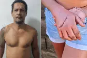 Homem é preso por tentativa de feminicídio após golpear esposa com enxada em Praia Grande