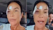 Ivete Sangalo confirma cirurgia após alta hospitalar e internação recente