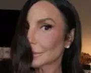 Ivete Sangalo relata dormência facial após cirurgia decorrente de queda em casa