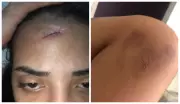 Jovem de 22 anos alega legítima defesa após esfaquear namorado em Maceió