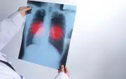 Paraíba registra aumento de 14% nos casos de tuberculose em 2025, com 1.581 notificações