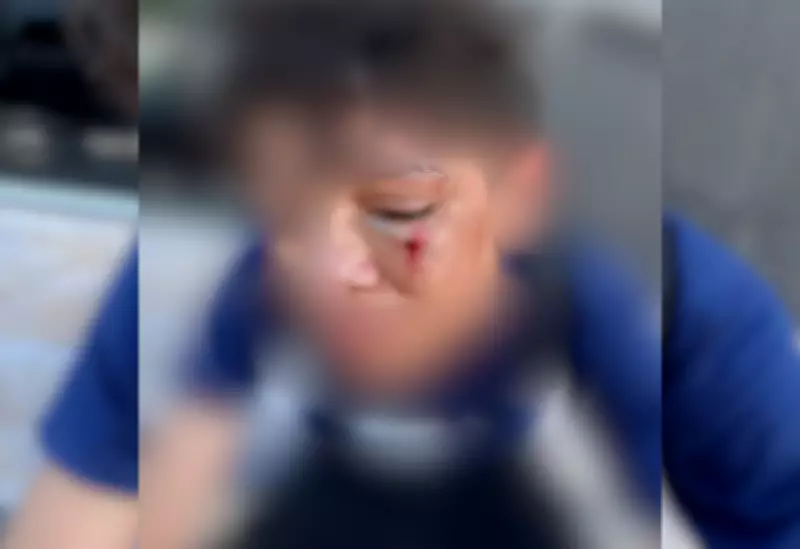 Adolescente de 14 anos é agredido dentro de sala de aula em Dianópolis, TO