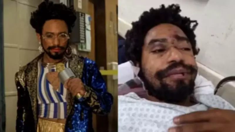 Agressão a ator drag queen em SP é investigada como racismo e homicídio tentado