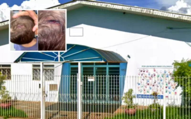 Bebê de 1 ano e 10 meses sofre corte na cabeça em creche municipal de Américo Brasiliense, SP