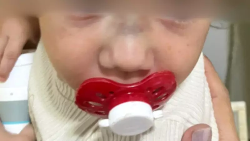 Bebê de 1 ano sofre fratura no nariz e hematomas após dia na creche em Valentim Gentil