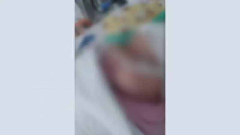 Bebê de 3 meses em estado grave após objeto ser deixado em pulmão durante intubação em Sergipe