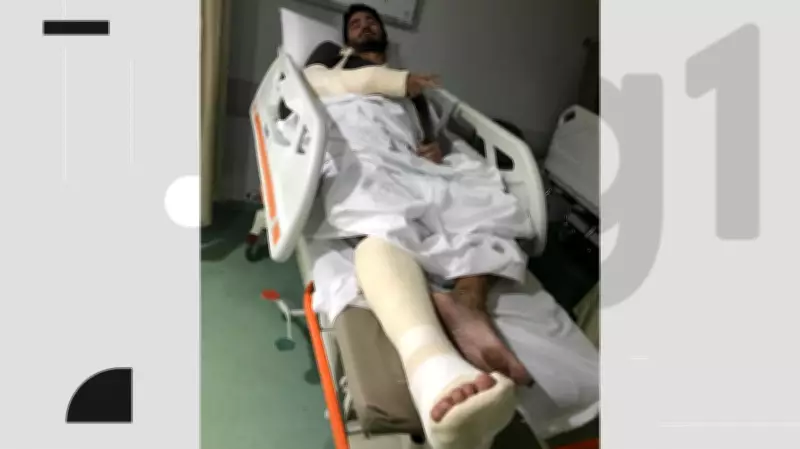 Ciclista é atropelado por patinete elétrico compartilhado no Recife e sofre fratura no cotovelo