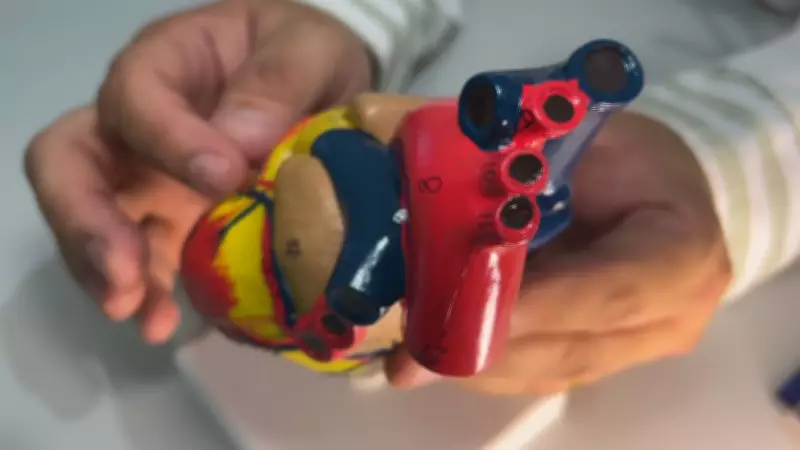 Colesterol alto exige mudança de hábitos para reduzir riscos cardiovasculares