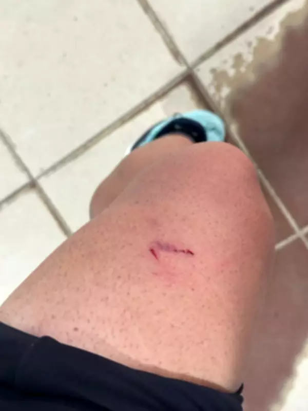 Corredor é perseguido por seis cães durante treino em Bicas, Minas Gerais