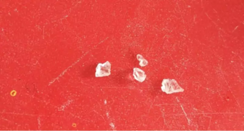 Criança internada após ingerir suco com cacos de vidro em restaurante de São Pedro da Aldeia