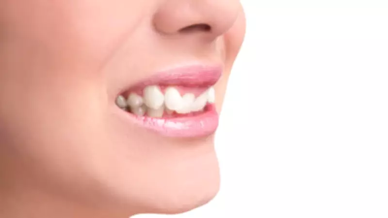 Dentes desalinhados podem causar dores de cabeça e problemas de saúde