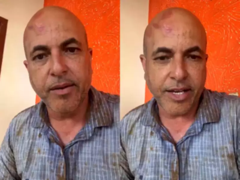 Deputado estadual de Rondônia sofre acidente de trânsito na BR-429 após carro aquaplanar