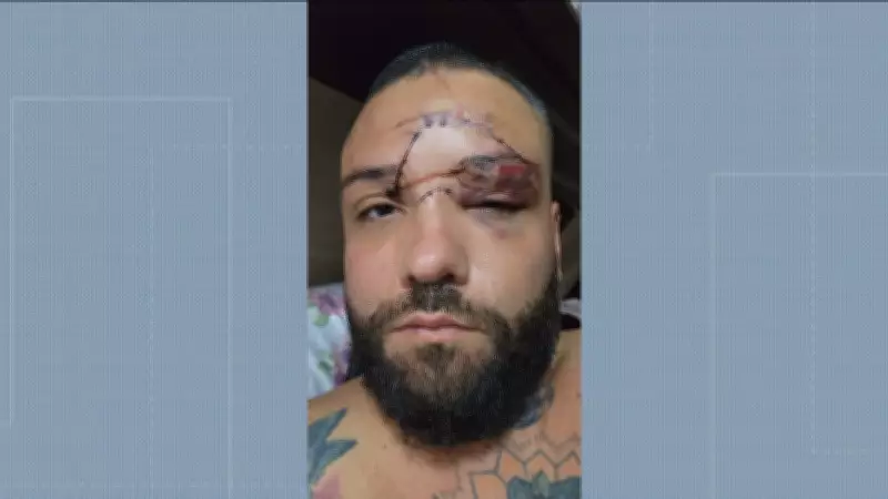 Designer de moda leva 35 pontos no rosto após agressão homofóbica em bar de Mesquita