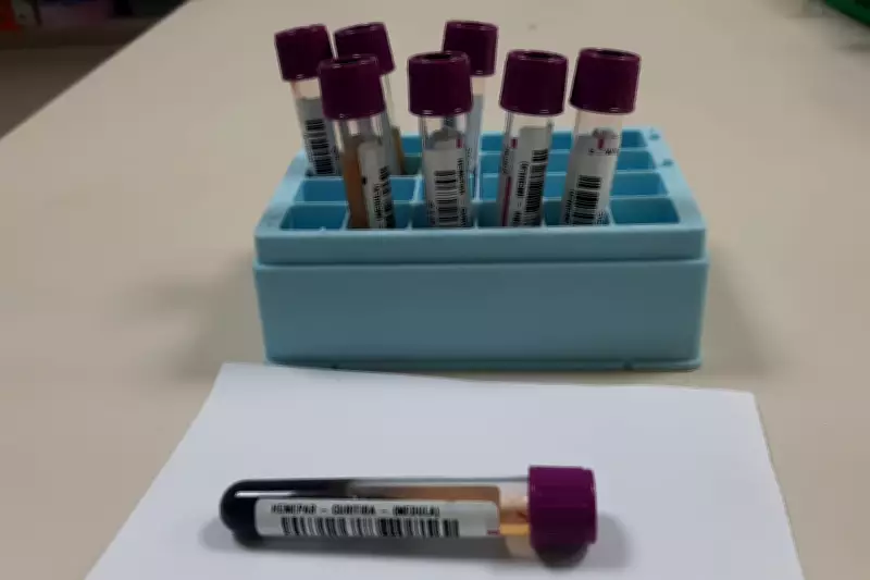 DF tem 667 pacientes aguardando doação de medula óssea sem hospital público credenciado