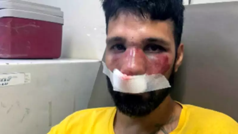 DJ é agredido por entregadores ao ser confundido com ladrão de bicicleta no RJ