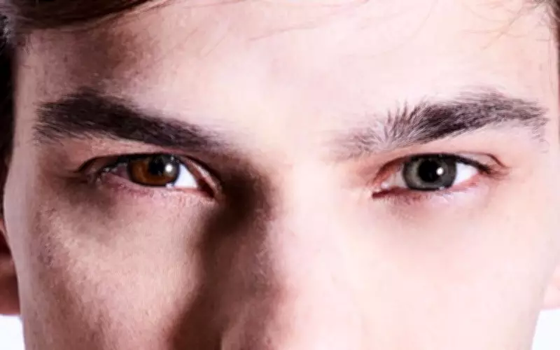 Empresário de Rio Preto celebra heterocromia: 'Olhos de cores diferentes'