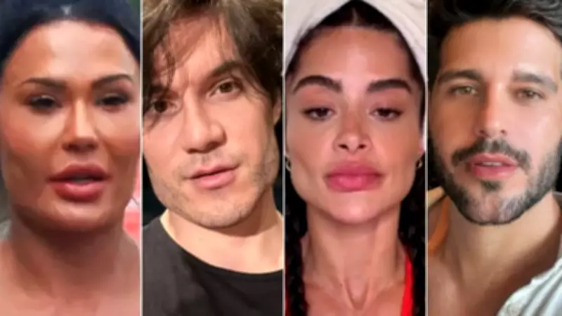 Gracyanne Barbosa remove preenchimentos faciais e adere à tendência de desarmonização