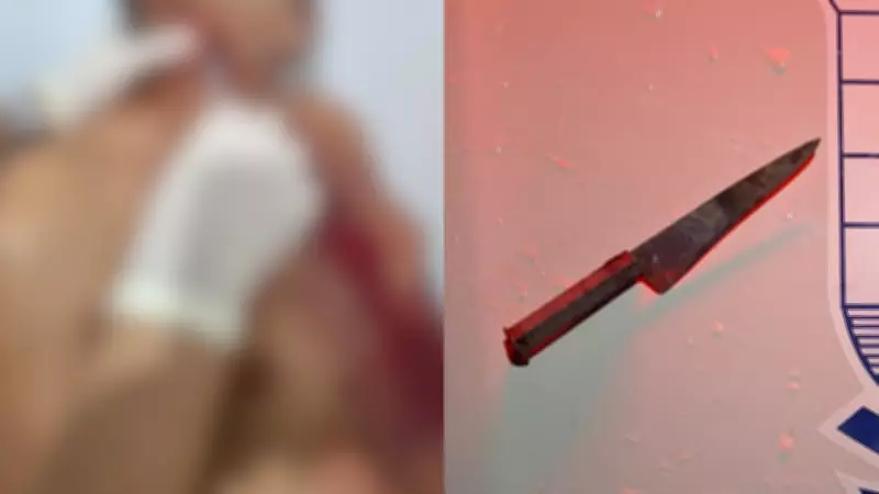 Homem é esfaqueado no pescoço e se recusa a denunciar companheira no PI