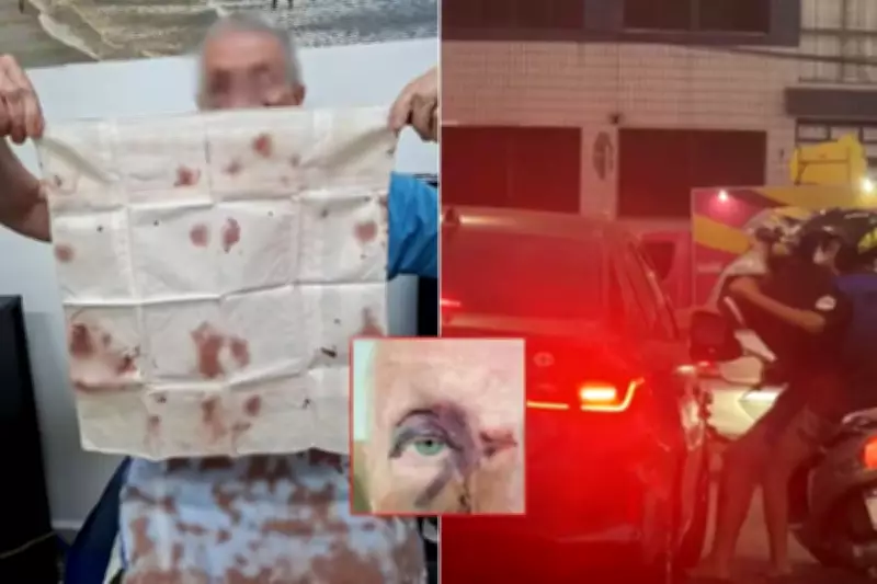 Idoso de 75 anos é agredido por motociclistas após acidente em Praia Grande, SP
