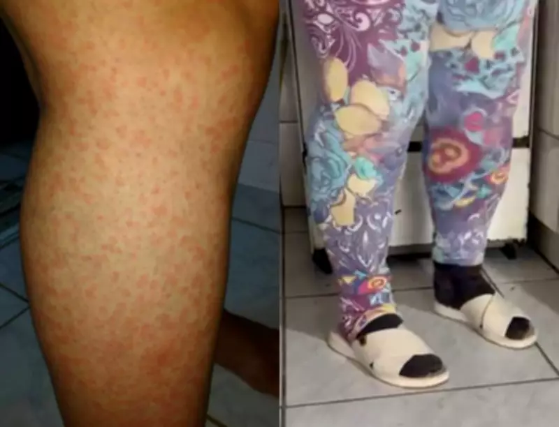 Ilhota (SC) enfrenta infestação de maruins e busca soluções emergenciais para controle