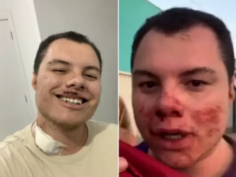 Influenciador agredido em festa universitária recebe alta após 6 dias internado em SP