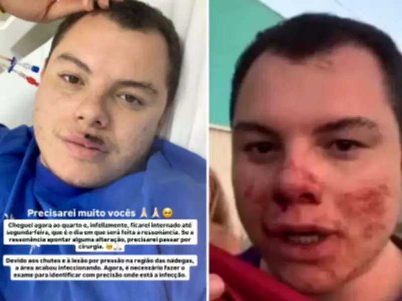 Influenciador agredido em festa universitária é reinternado com infecção grave
