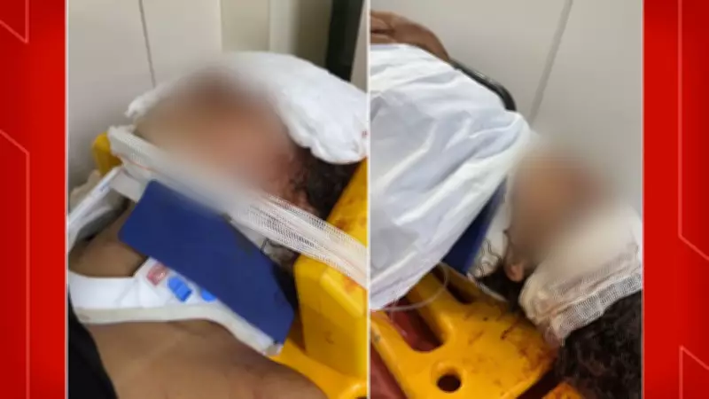 Jovem atropelada no DF após recusar convite de homens em carro