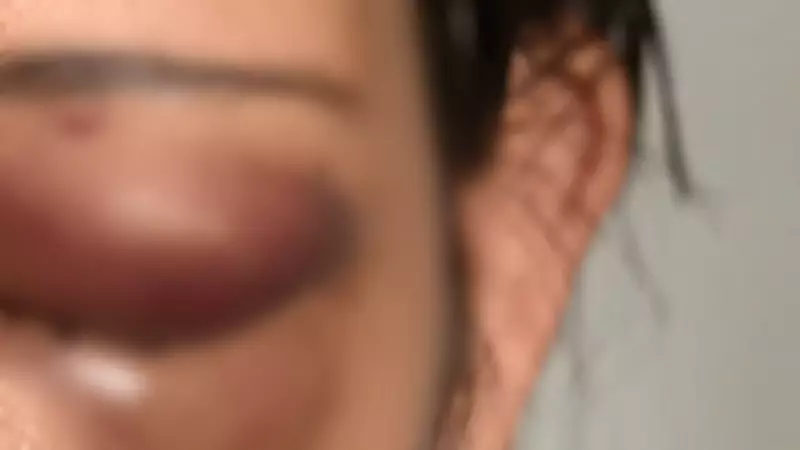 Jovem escapa de cárcere privado e agressões do marido na Serra, ES