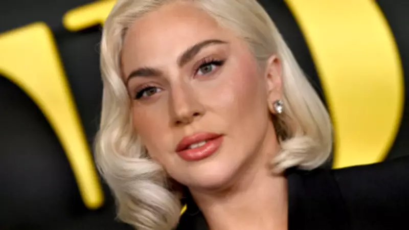 Lady Gaga cancela show por infecção respiratória após recomendação médica urgente