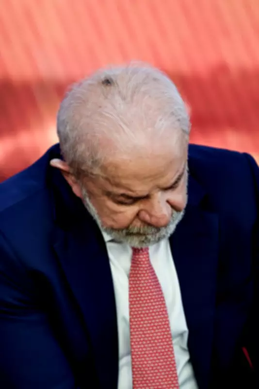 Lula passa por retirada de queratose e infiltração no punho em São Paulo