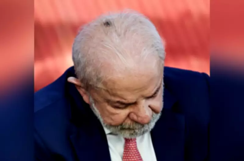 Lula passará por procedimento para retirar acúmulo de pele e tratar tendinite