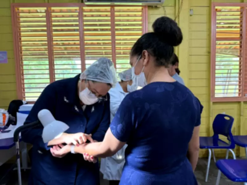 Macapá confirma seis casos de tuberculose latente em zona rural após diagnóstico de criança