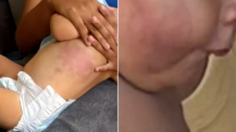 Mãe e namorado presos por tortura de bebê de 1 ano em Arraial do Cabo
