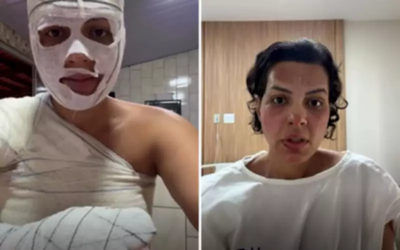 Nutricionista sofre queimaduras em 33% do corpo durante faxina em Goiânia