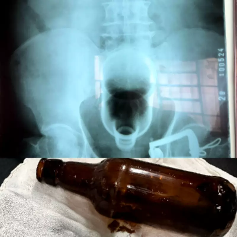 Plug anal é 'sugado' pelo intestino e mulher precisa ser internada; médicos alertam para riscos