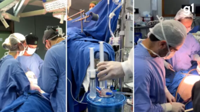 Primeira cirurgia com HIPEC no interior do RS trata câncer raro em Ijuí