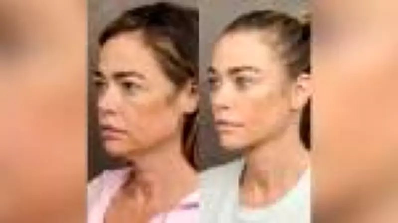 Revolução do Lifting Facial: Técnicas Modernas Conquistam Celebridades e Público Jovem