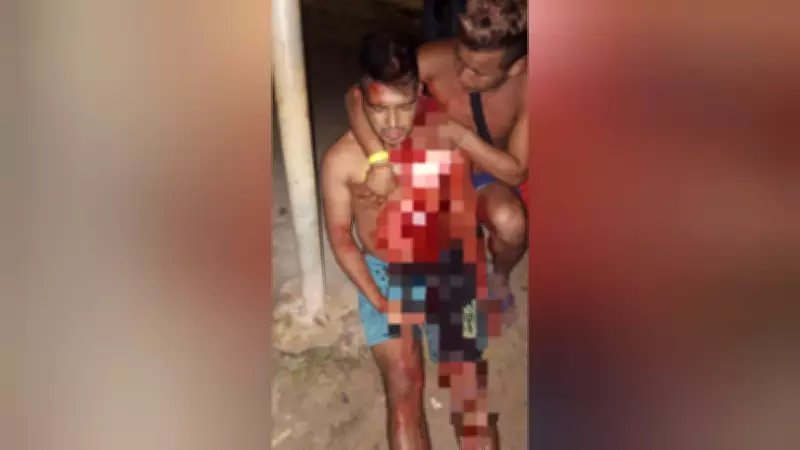 Tentativa de homicídio com facão atinge indígena de 27 anos em aldeia no Pará
