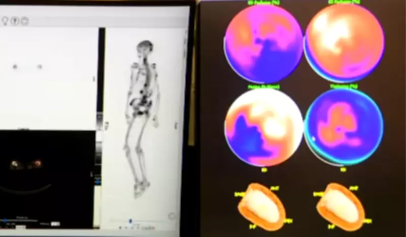Unicamp inaugura primeiro equipamento de IA e medicina nuclear para diagnóstico de câncer no SUS