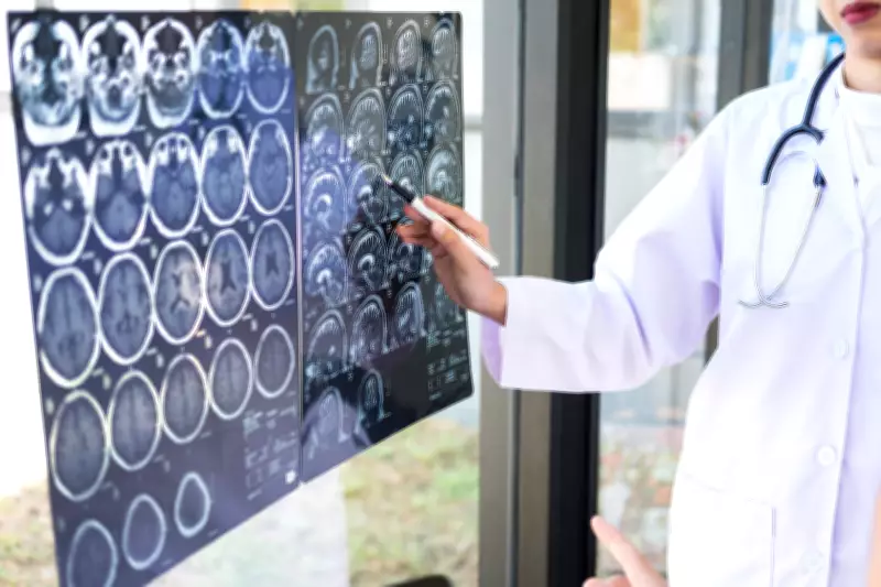 Uso recreativo de drogas pode dobrar risco de AVC, alertam estudos científicos