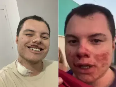 Influenciador agredido em festa universitária recebe alta após 6 dias internado em SP