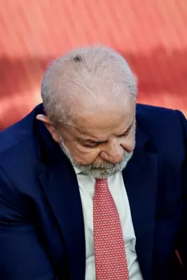 Lula passa por retirada de queratose e infiltração no punho em São Paulo