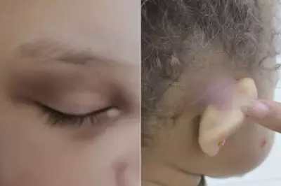 Pai encontra filha de 2 anos com hematomas após dia em creche municipal de Praia Grande